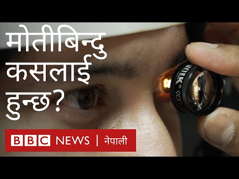 मोतीबिन्दु के पाको उमेरमा मात्र हुन्छ?- बीबीसी न्यूज नेपाली