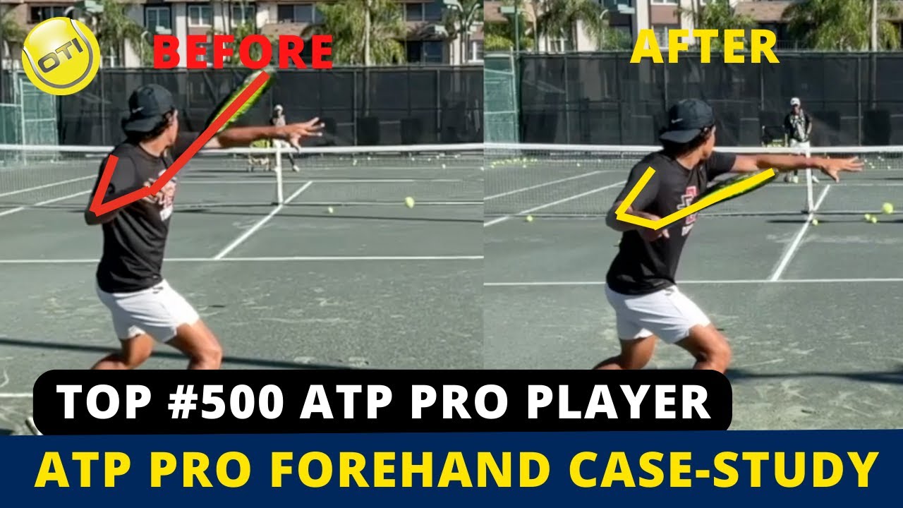 Forehand ATP Pro Player Case Study - YouTube