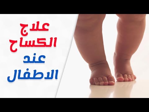 فيديو: كيفية علاج الكساح عند الأطفال