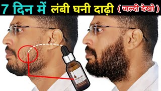 How To Grow Beard Faster & Thicker At Home । Grow Beard Faster । 100% Natural Beard Growth Oil