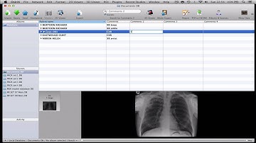 How to prepare and share databases in OsiriX