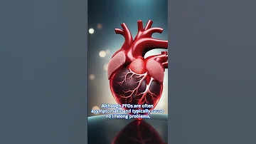 Patent Foramen Ovale And Paradoxical Cerebral Embolism 