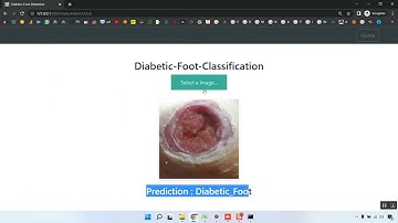 Diabetic Foot Ulcer Ischemia and Infection Classification Using EfficientNet Deep Learning Models