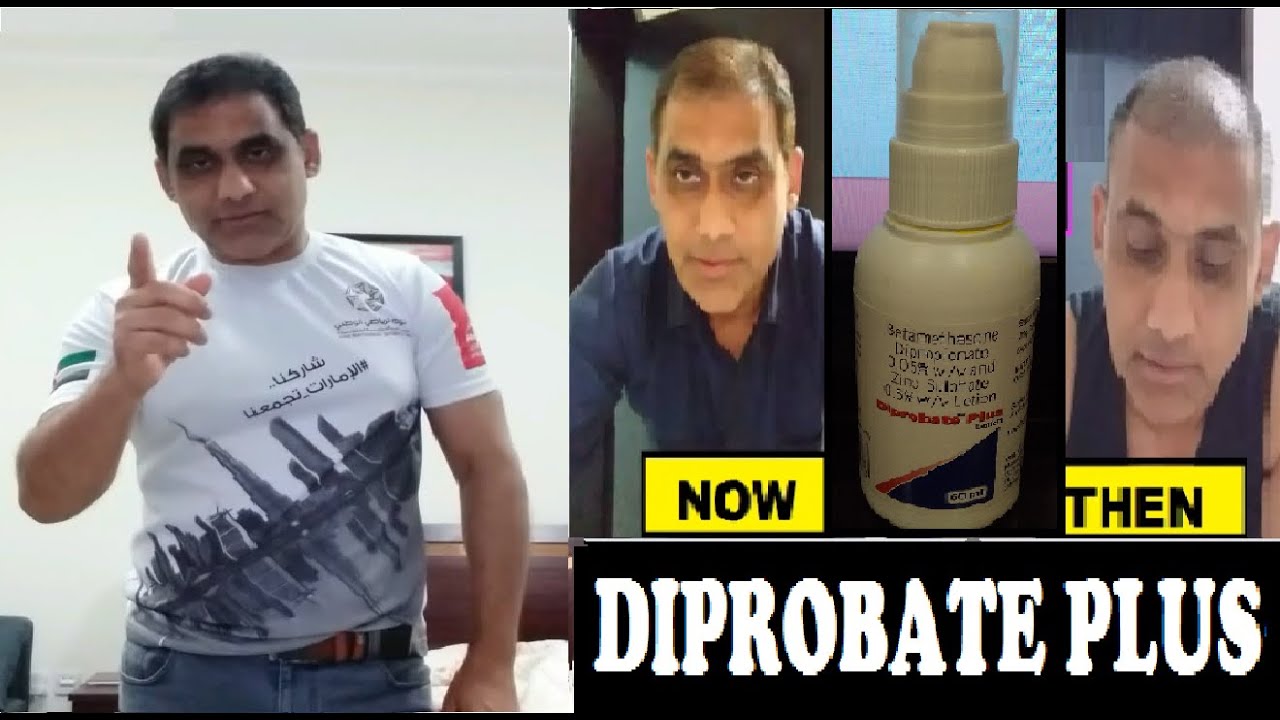 How Diprobate Plus Lotion Works? Regrow New Hair After Transplant