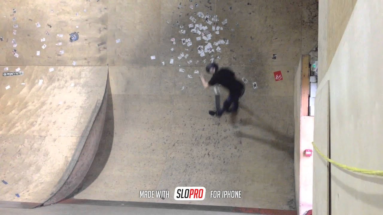 Rowan's finger blast YouTube