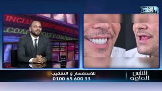 الناس الحلوة | دور زراعة الأسنان فى تعويض الأسنان المفقودة مع دكتور محمود عمار
