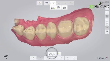 3D BioCAD - TRIOS 3 A Single Crown Scan Path Navigation