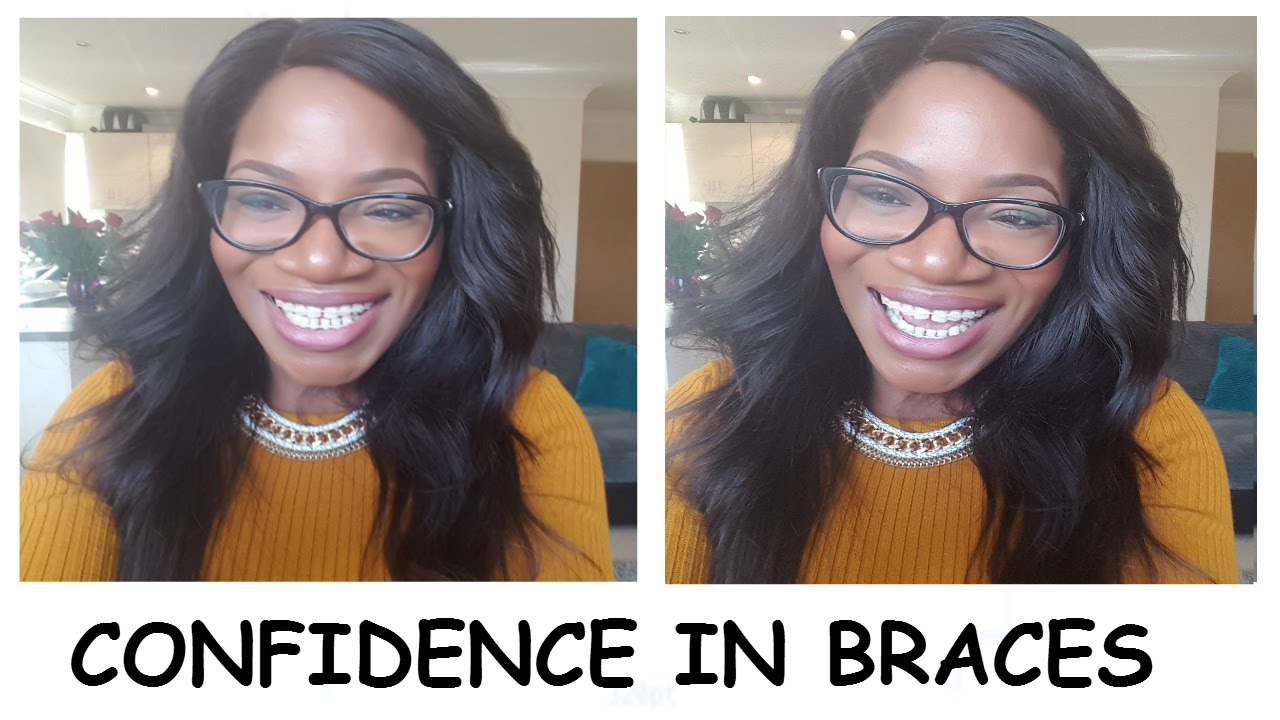 6 My Braces Journey 5 practical tips on Confidence with Braces! Must
