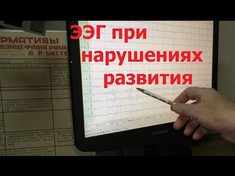 ЭЭГ при задержках