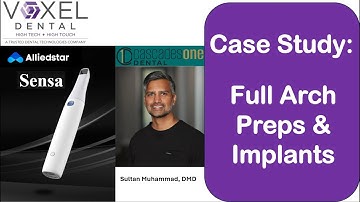 Allied Star Sensa  -  Full Mouth Preps and Implants