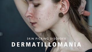 I can't stop picking my skin | Dermatillomania + my skin care