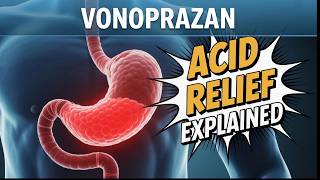What is Vonoprazan? || Best Medicine to reduce stomach acidity