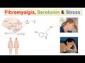 Fibromyalgia, Serotonin & Stress | 5-HTP, Decreased Serotonin and Worsening Fibromyalgia Symptoms