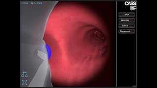 CASS Virtual Reality Bronchoscopy Simulator - Double Lumen Tube screenshot 3