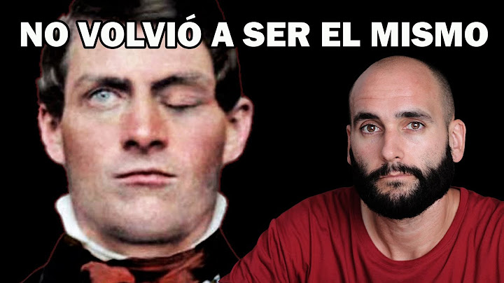 ¿VOMITÓ parte de su CEREBRO? | La Terrible Historia de Phineas Gage
