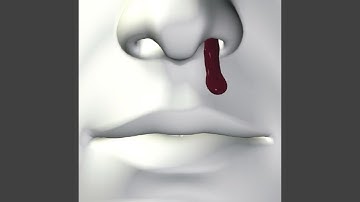 nose bleed