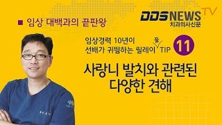 김영삼원장의 하악 수직매복 사랑니발치 