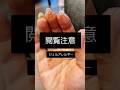 今気をつけますか?一生後悔しますか? 対策動画なども出していきますのでチャンネル登録してね#ジェルネイル #アレルギー#ネイリスト#接触性皮膚炎#ネイル 検定#セルフネイル