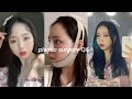 2 years after my plastic surgery in korea...︱SURGERY Q&A