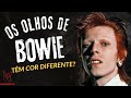 Por que os olhos de David Bowie são diferentes?