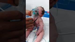 How to Use a Nebulizer for Babies | Step-by-Step Medical Guide