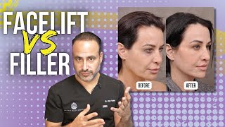 Fillers Vs Facelift Choosing The Best Facial Rejuvenation Method What You Need To Know