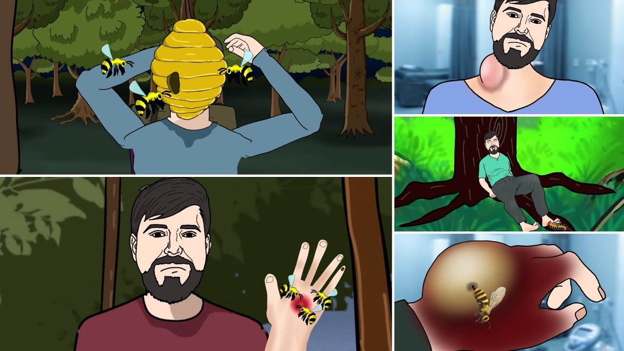[ASMR ANIMATION] Help MrBeast get the bee🐝, Bee Stinger, Centipede ...