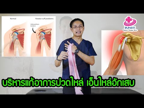 บริหารแก้อาการปวดหัวไหล่ เอ็นไหล่อักเสบ | ตอบคำถามกับบัณฑิต EP.61