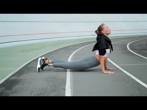 How Amputation Changed My Life – The Truth You Need to Hear!