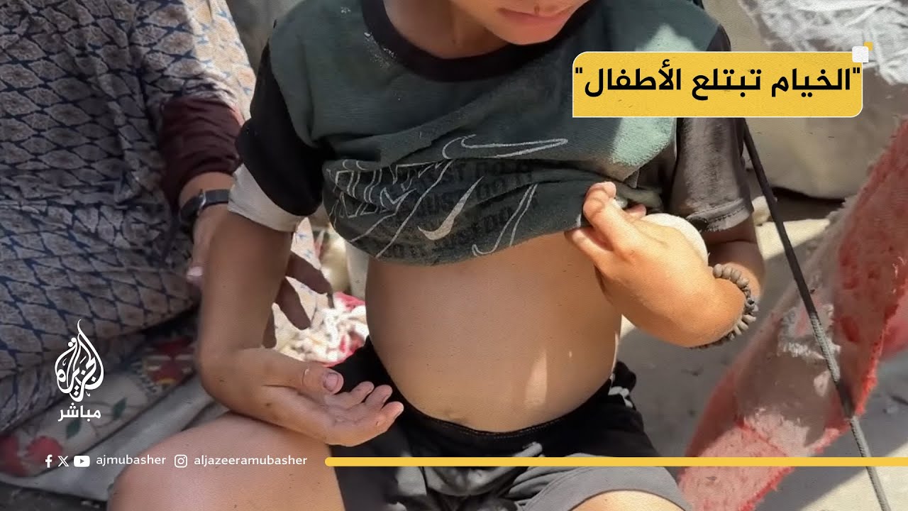 حياة الأطفال في الخيام.. أمراض وتلوث لا يرحم