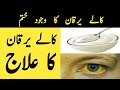 Kalay yarkan ka ilag  hepatitis treatment  in urdu  hindi  awami totkay