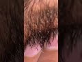 Hair massage hair beard hair removal