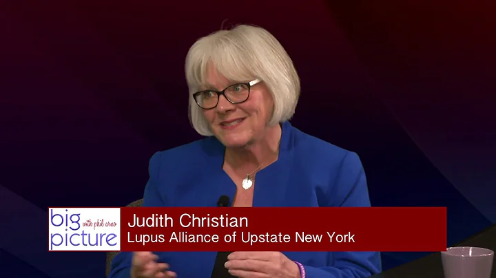 Judith Christian, Lupus Alliance of Upstate New York