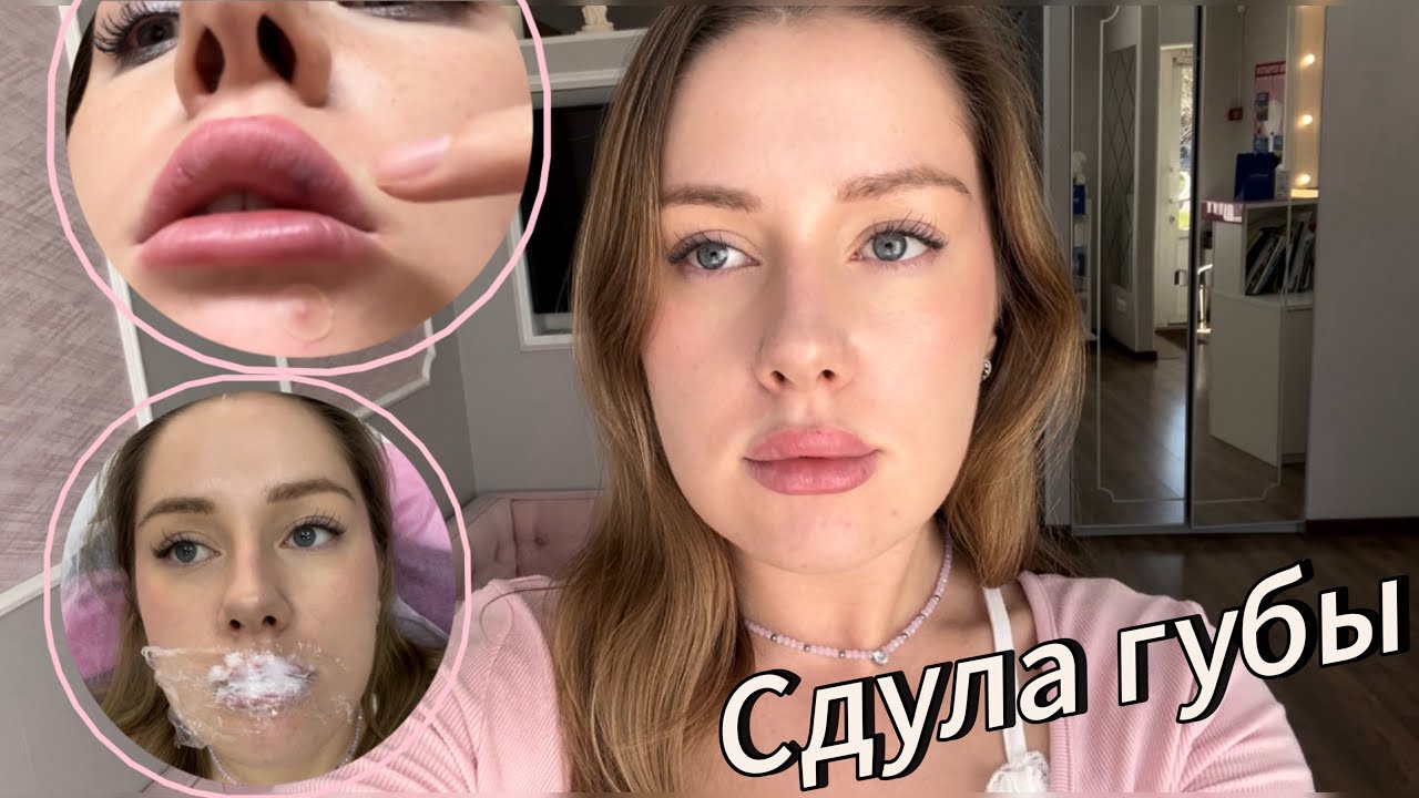 УДАЛИЛА ГУБЫ | О ЧЕМ МОЛЧАТ КОСМЕТОЛОГИ | ЛОНГИДАЗА МОЙ ОПЫТ