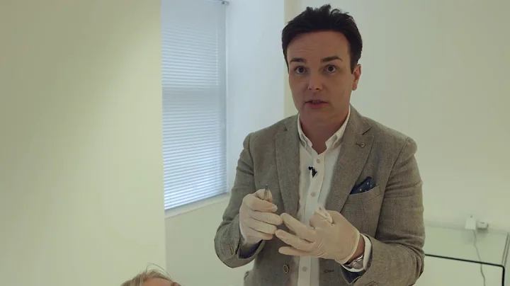 Perioral fillers - nose to mouth lines, nasolabial...