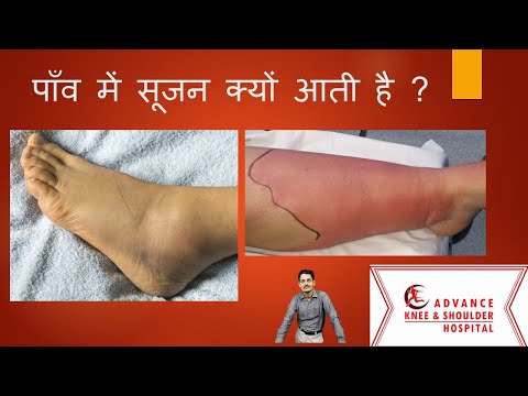 वीडियो: फेरेट्स में सूजन आंत्र रोग