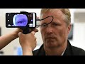 Introducing smartphone non-mydriatic retinal camera nun IR