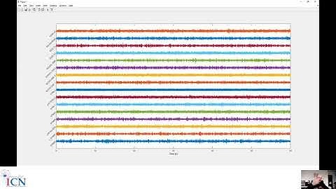 Tutorial practical LFP recording import and rereferencing 2 (Matlab) - Julian Neumann