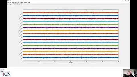 Tutorial practical LFP recording import and rereferencing 2 (Matlab) - Julian Neumann