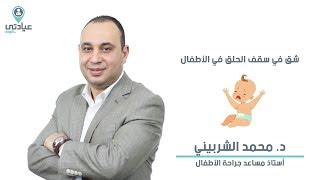 شق في سقف الحلق مع د . محمد الشربيني - دكتور جراحة أطفال بالمنصورة