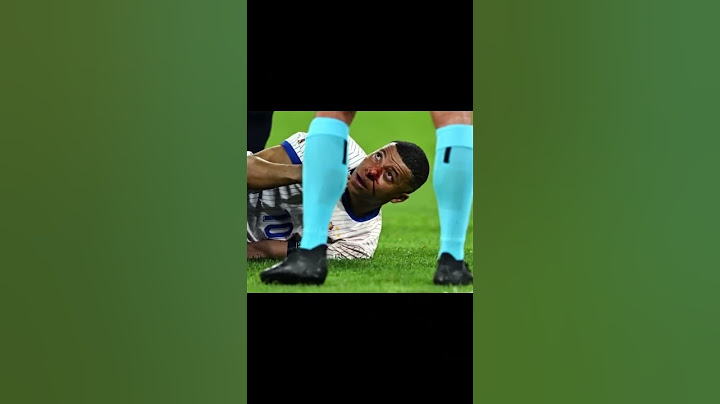 Mbappé nez cassé 🇫🇷 masque 🇫🇷 #football