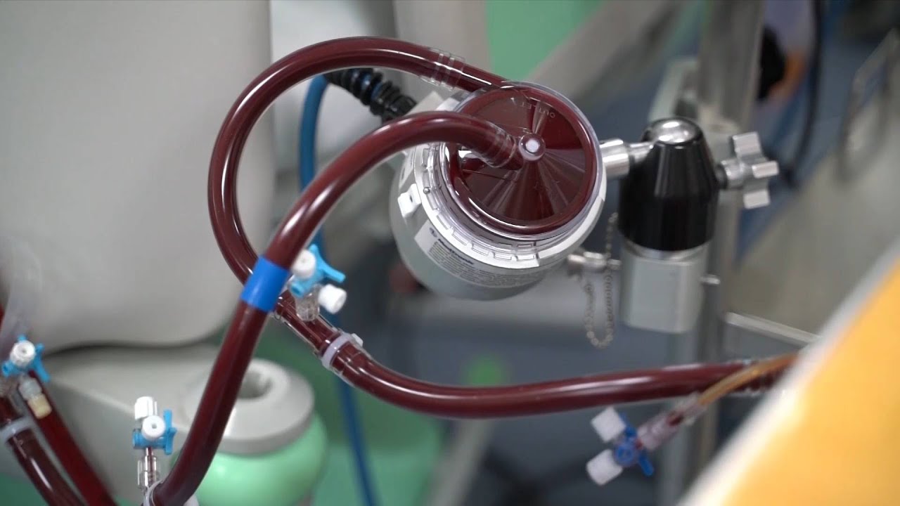 GLOBALink | China-made ECMO machine put in clinical use