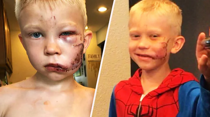 Boy Who Saved Sister in Dog Attack Gets Call from Spider-Man - DayDayNews