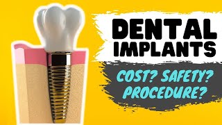 Dental Implant Procedure { Dentist Reviews Implants Cost & Risks }