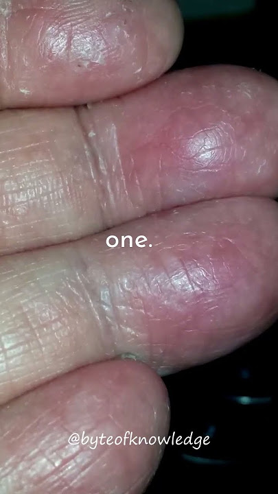 The person WITHOUT fingerprints... #shorts