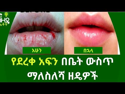 Ethiopia:- የደረቀ አፍን በቤት ውስጥ ማለስለሻ ዘዴዎች | Nuro Bezede Girls