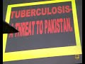 Pulmonary Tuberculosis 🫁🫁 MANAGEMENT OF ADULT TUBERCULOSIS DISEASE, MEDICINE LECTURE
