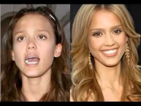 ცნობილები მაკიაჟის გარეშე - www.infotime.ge