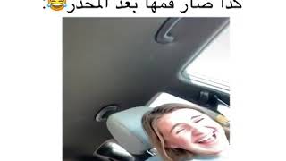 كذا صار فمها بعد المخدر ?: