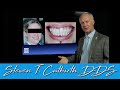 Failed Anterior Implants - Dental Minute with Steven T. Cutbirth, DDS